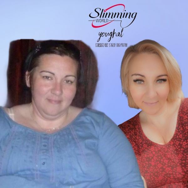 Жительница Ирландии похудела на 70 кг из-за угрозы умереть от ожирения. Фото до и после